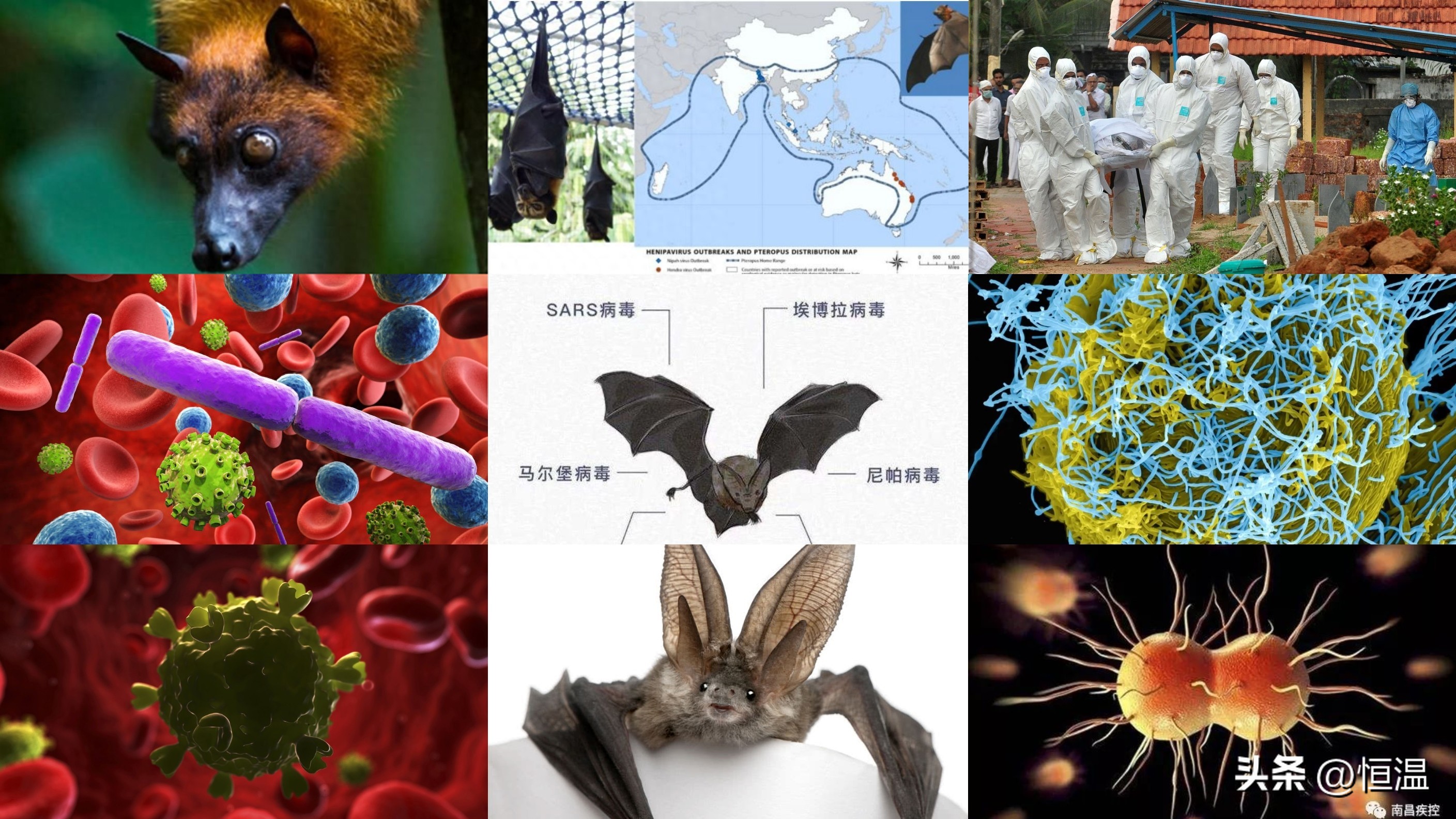 南亚疫情告急！致命尼帕病毒突破医疗防线，传播韧性惊人