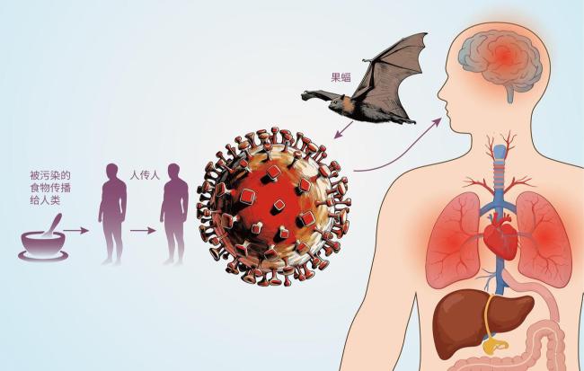 印度尼帕病毒疫情溯源有新进展 或因饮用被果蝠污染饮品